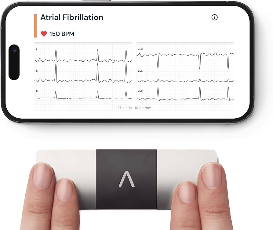 Alivecor Kardiamobile